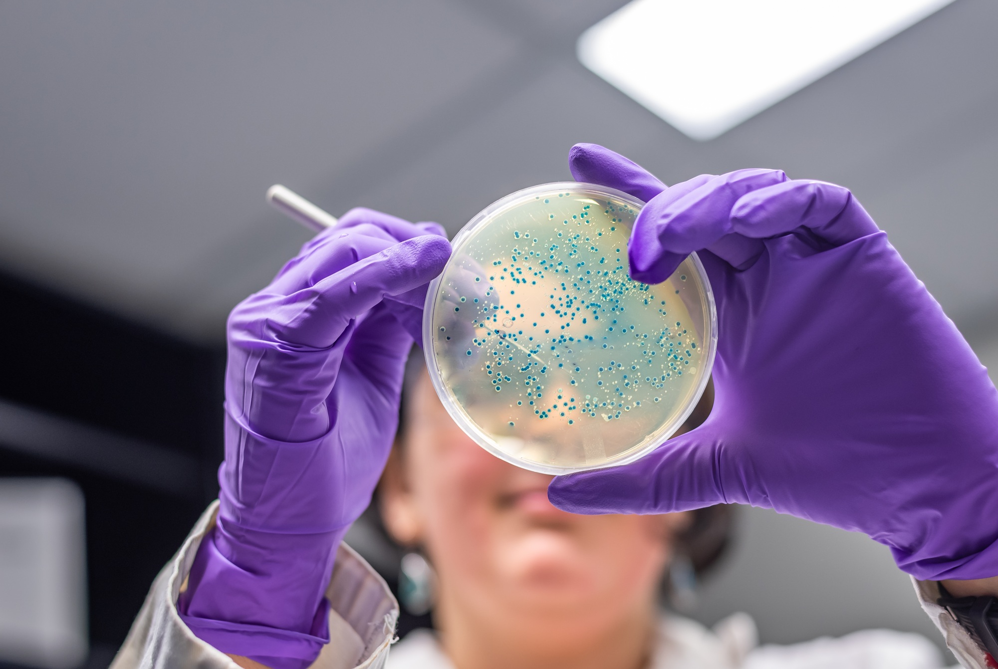 Protected: Infection Prevention and Control in a Care Setting